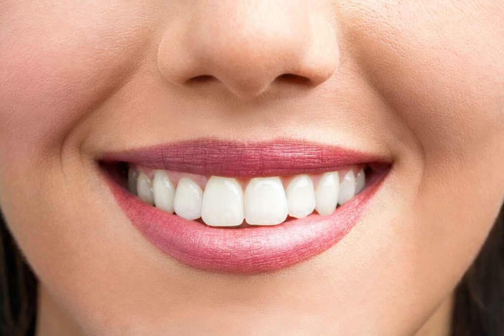 smilende kvinde. invisalign kan bruges til at rette tænder.