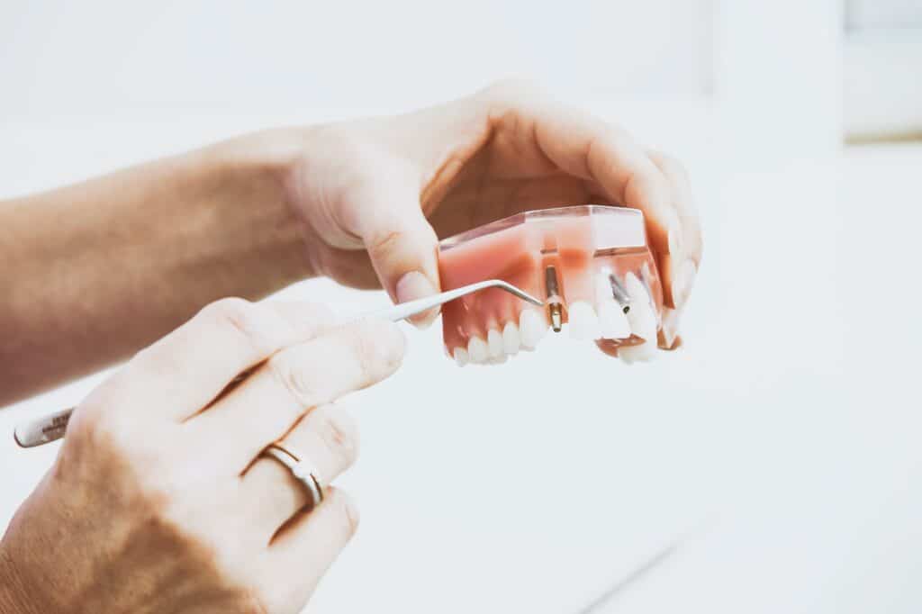 en hånd holder et gebis mens den anden hånd undersøger en tandprotese med et tandlæge instrument